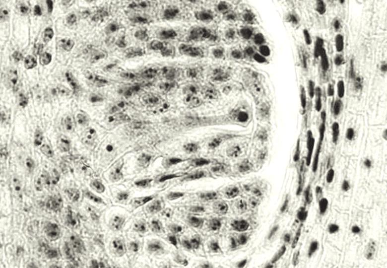 7 8 Fot. 7. Zap³odnienie j¹der biegunowych Phot. 7. Fertilization of polar nuclei Fot. 8. Wielokomórkowy zarodek i bielmo w aposporowym woreczku zal¹ kowym.