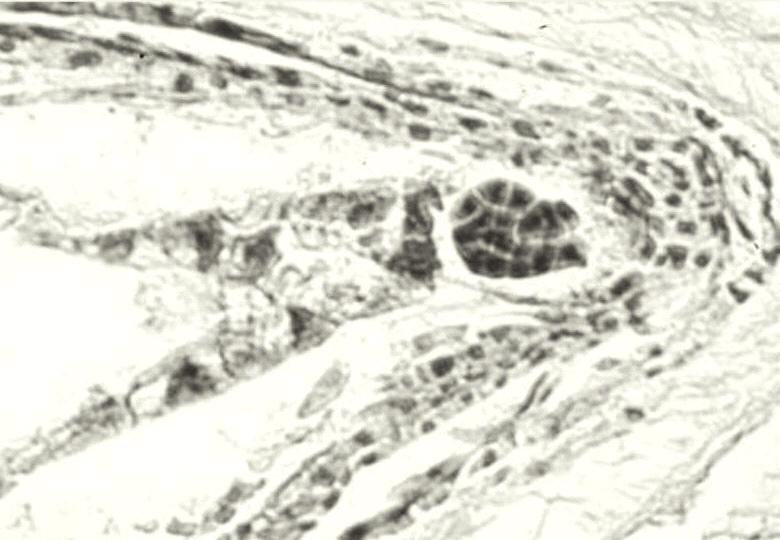 1 8. Macrosporogenesis and apomictic way of embryo formation in P. pratensis. 4.