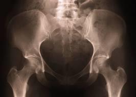 Jama brzuszna (cavum abdominis) jest ograniczona od góry przeponą, od dołu talerzami kości biodrowych, składa się z jamy otrzewnej i przestrzeni