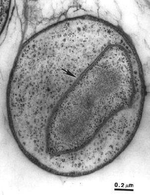 PLANCTOMYCETES dysonans klasyfikacyjny