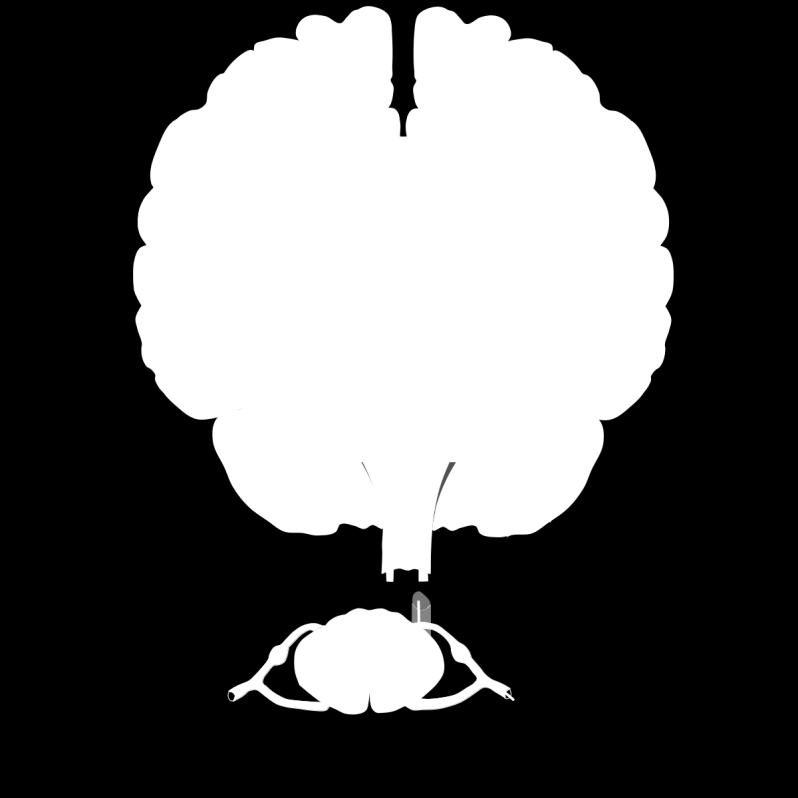 : The Role of Evoked Potential Monitoring in