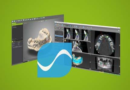 Praca z oprogramowaniem oparta jest na danych medycznych pacjenta, takich jak CT (tomografia komputerowa) lub CBCT DVT (tomografia cyfrowa wolumetryczna) przetwarzanych przez codiagnostix.