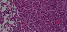 #CC3 + cells/m mm 2 tumor 25 2