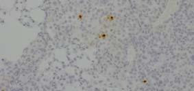 (A), H&E and cleaved caspase 3