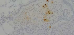 staining (2x) in vehicle