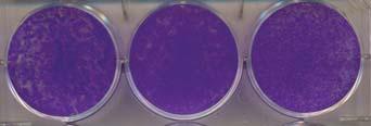 Fig. S5 A B ive viability Relat.6.4.2.8.6.4 sensitive resistant resistant 2 nm 5nM sensitive resistant resistant 2.2 5 Bortezomib (nm) Figure S5. Generating Bortezomib-resistant KP cell lines.
