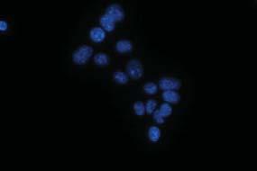 sensitive KP cell lines.