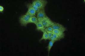 with antibodies for p65 (A)
