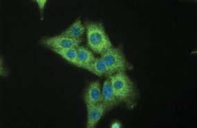 Alexa-488 secondary antibody