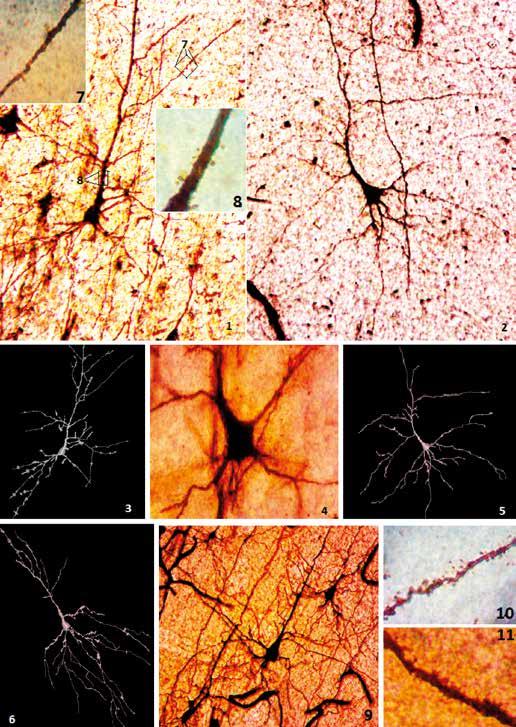 Age-related dendritic and spinal alterations of pyramidal cells of the human visual cortex Fig. 1.