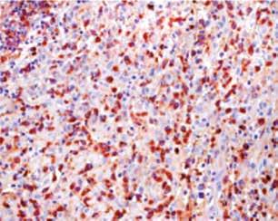 However, it should be noted that IgG may also be produced by some B lymphocytes differentiating into plasma cells. 40x.