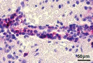 Effect of oral administration of pig spinal cord hydrolysate on clinical and histopathological symptoms of eae