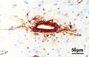 Kaja Kasarełło, Roman Gadamski, Piotr Piotrowski, Katarzyna Kurzepa, Barbara Kwiatkowska-Patzer, Andrzej W. Lipkowski A B C D Fig. 6. Astrocytic reaction.