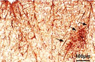 B, C) Enhanced astrocytic reaction, EAE animals, fed with hydrolysate in doses 5, 20 mg/kg.