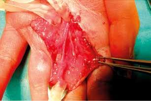 cross-section of the tumours. tion performed on 30.09.
