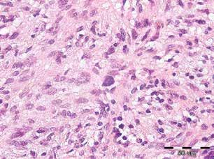 observed calcification only in two out of B C D E F Fig. 8.