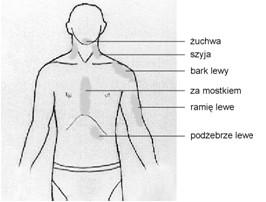 Typowe okolice bólowe przy zawale serca Czasami Dolegliwości którymś przeszedł Pierwsza V. 1. zadaniem 2.