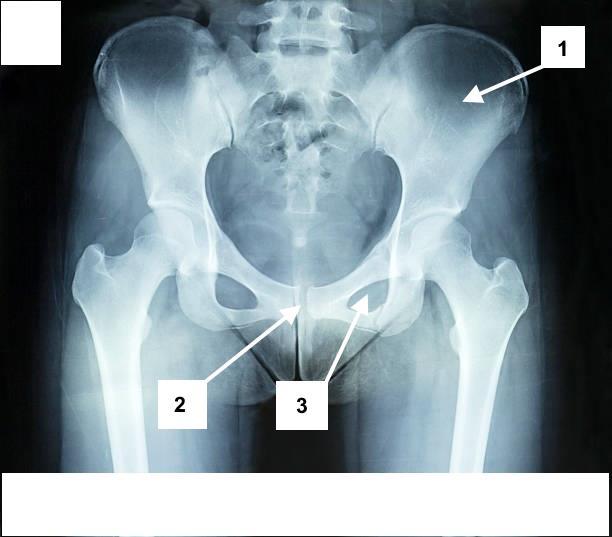 Radiogram Nazwy struktur anatomicznych