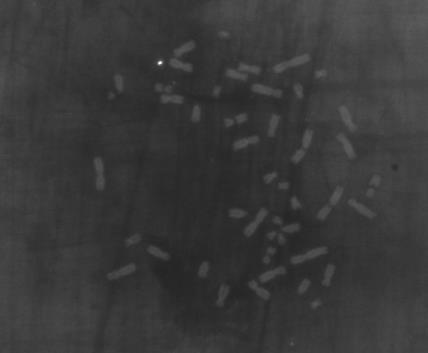 Wdrożenie techniki FISH do malowania centromerów w chromosomach ludzkich w celu jednoznacznego rozpoznawania chromosomów policentrycznych i identyfikacji mikrojąder indukowanych przez promieniowanie