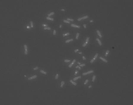 Buraczewska 1 1 Instytut Chemii i Techniki Jądrowej Celem badania było wdrożenie metody FISH (fluorescence in situ hybridization) w dozymetrii biologicznej, która umożliwia spontaniczne łączenie się