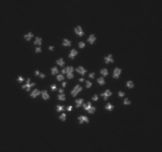 Rysunek 2. Preparaty chromosomowe wybarwione sondą PNA próba (po lewej i barwnikiem DAPI (po prawej).