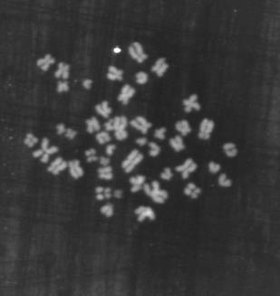 Widoczna komórka z chromosomami oraz wyraźny sygnał wiążący się z innymi elementami niż centromery.