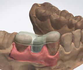 More information at www.3shape.com info@3shape.