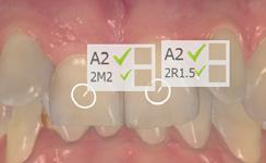użytkownika nowej aktualizacji lub biblioteki w systemie Dental