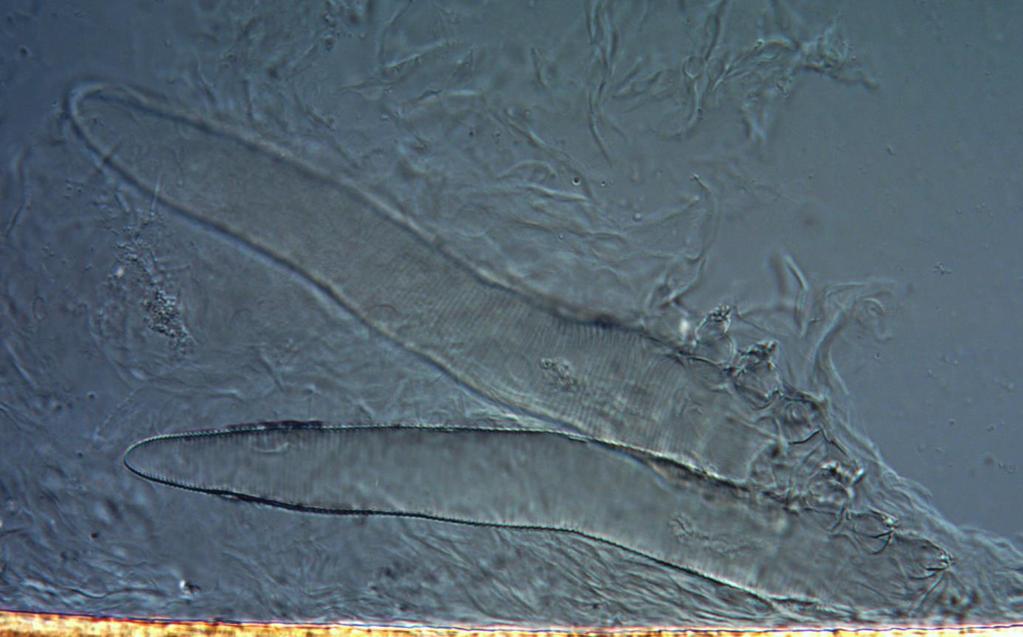 Fig. 1. Demodex folliculorum in a preparation taken from the patient's eyelashes Cat demodicosis Demodex cati and Demodex gatoi are species of Demodex mites that occur in cats.