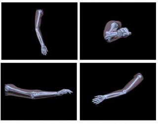możliwość wykonywnia zdjęć rentgenowskie całej kończyny górnej (od połowy ramienia do ręki) model zawiera sztuczne kości wykonane z realistycznego, opatentowanego materiału naśladującego prawdziwe
