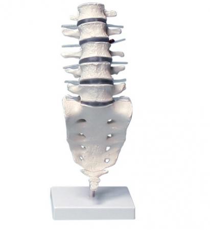 Model lędźwiowego odcinka kręgosłupa z kością krzyżową Nr ref: MA01027 Informacja o produkcie: Model lędźwiowego odcinka kręgosłupa z kością