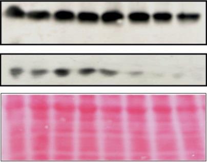 Katedra Cytobiochemii MATERIAŁ Nowotwory endometrium, jelita grubego, piersi, prostaty, tarczycy, białaczka limfocytowa B-komórkowa METODY Hodowle komórkowe, modele zwierzęce Real-Time PCR Western