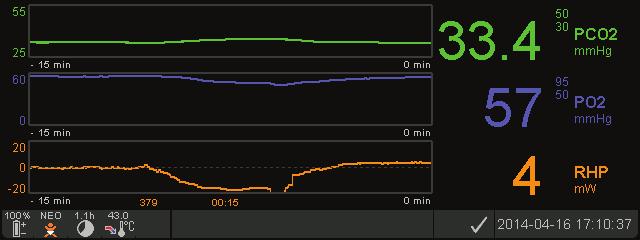 SenTec Digital Monitoring System Nieinwazyjne