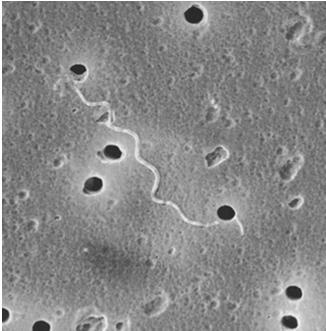 Czynnikiem etiologicznym boreliozy z Lyme są krętki tworzących komplekss Borrelia burgdoferii sensu lato, do której zalicza się obecnie 18 genogatunków.