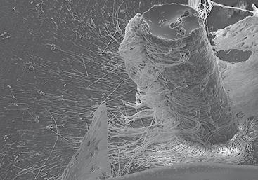 COLTENE specjalista endodoncji COLTENE jest synonimem doskonałości w zakresie produkcji niezawodnych materiałów endodontycznych.