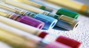 Nowotwory kobiecych narządów płciowychleczenie Podstawą terapii nowotworów kobiecych narządów płciowych jest zabieg chirurgiczny.