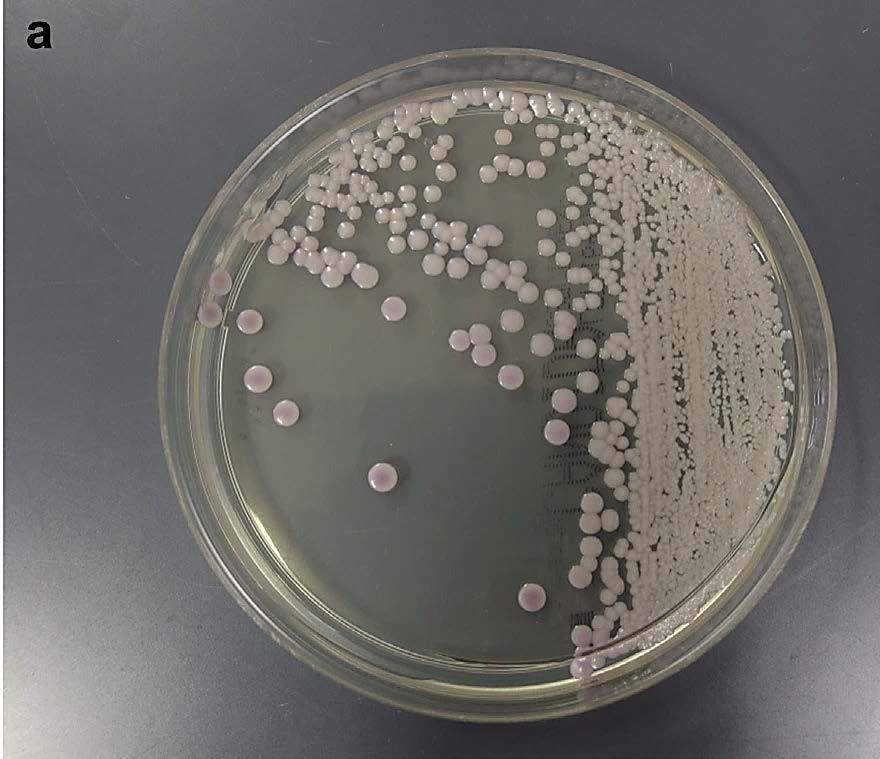 Kolonie Candida auris w hodowli na podłożach stałych (a) CHROMagar Candida w 35 C w 72 h / (b)