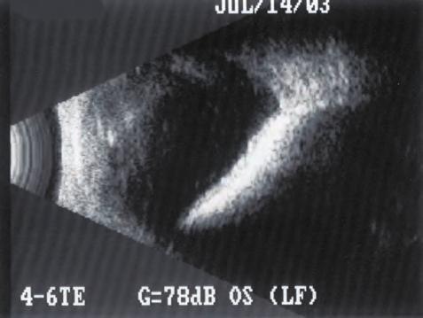 Siatkówka. 85 Ryc. 5.56.