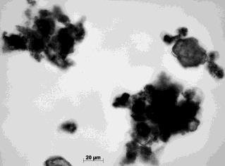 Zdjęcia mikroskopowe zawiesiny łupka po flokulacji flokulantami magnafloc