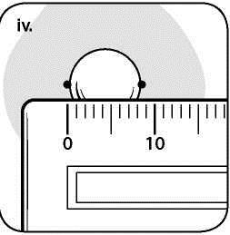 8.2 Instrukcje dotyczące badań w kierunku wykrywania gruźlicy Skórna próba tuberkulinowa Mantoux 3.