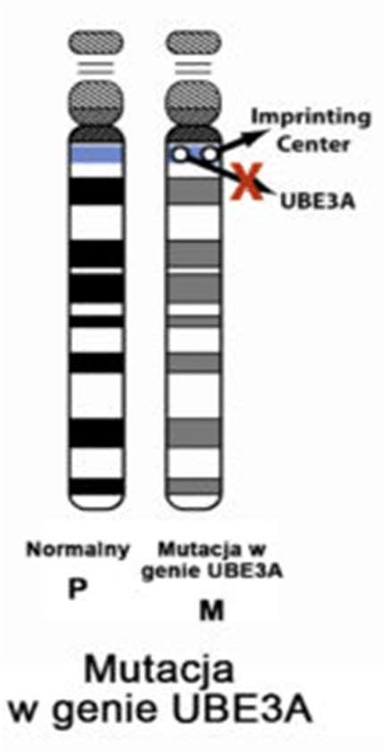 Mutacja genu UBE3A - dotyczy około 5-11% przypadków.