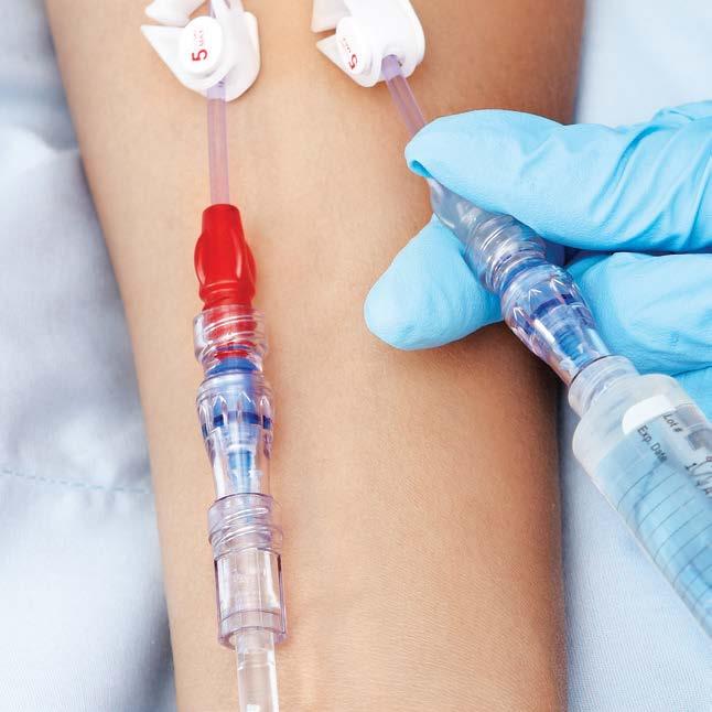 Neutron NanoClave MicroClave Clear Zawór bezigłowy kompensujący Przeznaczony Najlepszy