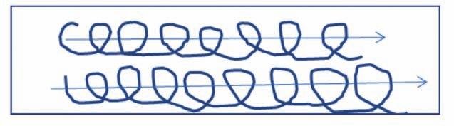 PROCEDURA NR 11 Do najczęstszych skórnych powikłań poinsulinowych zalicza się lipodystrofię i jej postaci: lipohipertofię, lipoatrofię, amyloidozę.