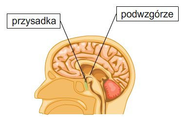 Podkreślmy raz jeszcze w zdecydowanej większości przypadków zespół Pradera-Williego nie jest skutkiem dziedzicznej wady przekazanej przez rodzica.