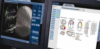 Wysokowydajny system PACS dla kardiologii W tradycyjnie zorganizowanym szpitalu oddziały radiologii i kardiologii sà na ogół wyposa one w dwa niezale nie działajàce systemy archiwizacji i dystrybucji