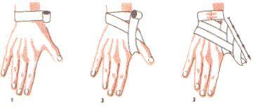 Pierwszy jest bliżej nadgarstka (2), ostatni - bliżej czubka kciuka. Zakończenie również na nadgarstku (lub obwojem kolistym wokół kciuka) (3).