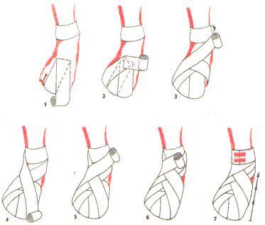 Bandażowanie kończyny dolnej Stopa Opatrunek kłosowy stopy pełny wstępujący Rozpoczynamy obwojem kolistym w stawie skokowym.