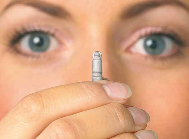 System implantów stomatologicznych