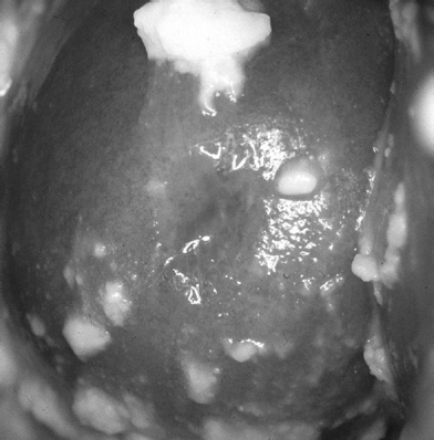 papillae and on a degree of hemostasis in the examined vessels.