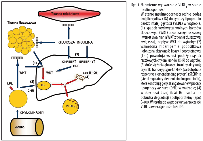 Zaburzenia metabolizmu lipoprotein w zespole